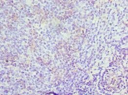 MRE11A / MRE11 Antibody (aa1-205)