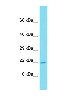 Polyclonal Rabbit anti-Human ATP6V0E2 Antibody (aa73-122, WB)