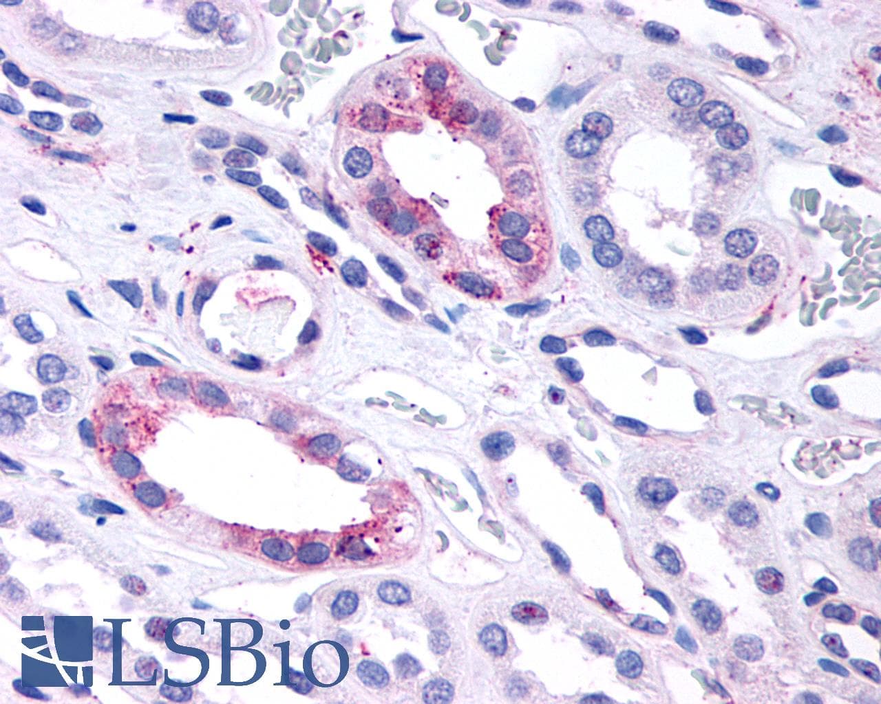 PathPlus™ Polyclonal Rabbit anti-Human GPR146 Antibody (C-Terminus, IHC)