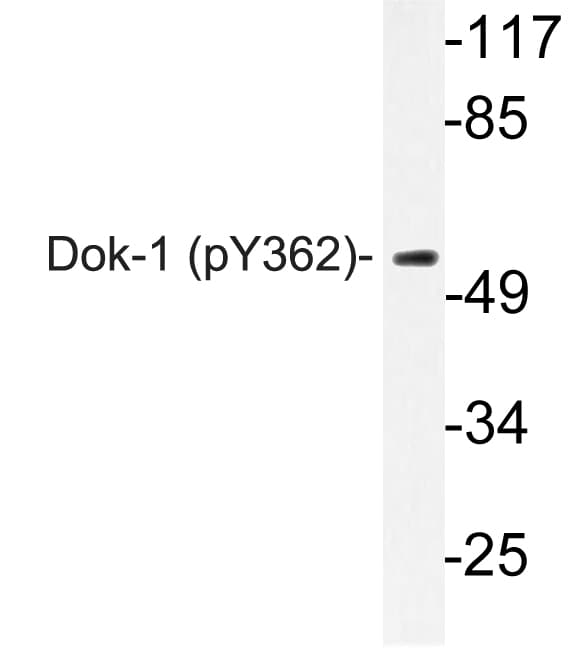 Polyclonal Rabbit anti-Human DOK1 Antibody (phospho-Tyr362, IF, WB)