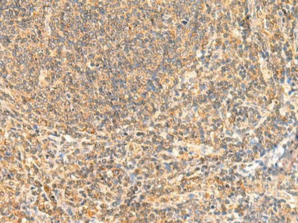 ZNF581 Antibody