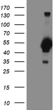 FOXP3 Antibody (clone OTI3D1, Carrier-free)