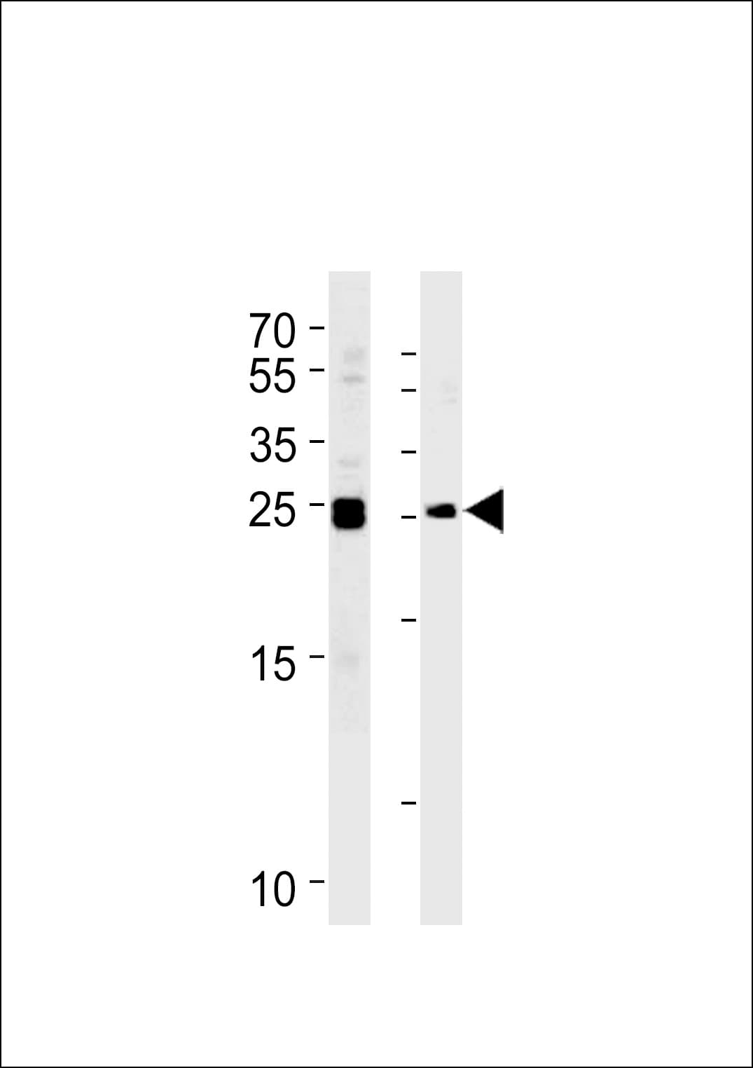 MOB1B / MOBKL1A Antibody (aa177-206)