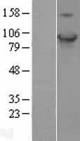 HID1 / C17orf28 Protein (Over-Expression Lysate Myc-DDK (Flag))