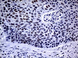 NBN / Nibrin Antibody (aa461-754, clone OTI1G10, Carrier-free)