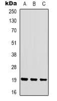 Polyclonal Rabbit anti-Human STMN1 / Stathmin / LAG Antibody (N-Terminus, IHC, IF, WB)