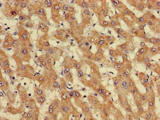 GIPC1 / GIPC Antibody