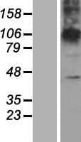 ZDHHC23 Protein (Over-Expression Lysate Myc-DDK (Flag))