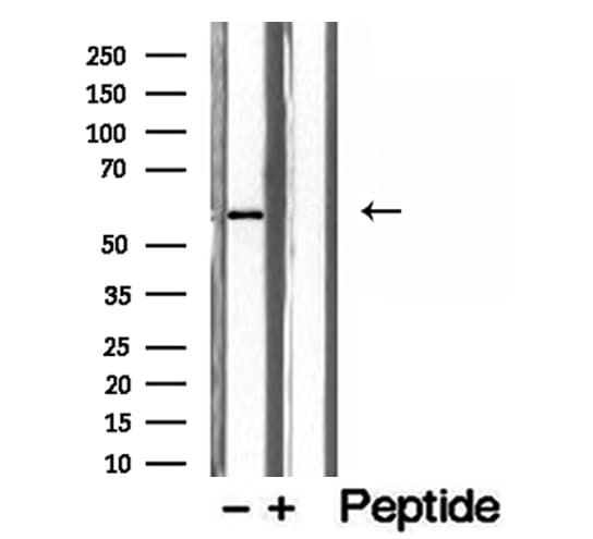 PHGDH Antibody
