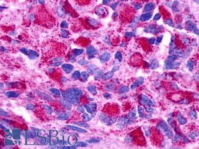 PathPlus™ GPR174 Antibody (Extracellular Domain)