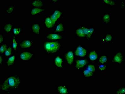Polyclonal Rabbit anti-Human S100A16 Antibody