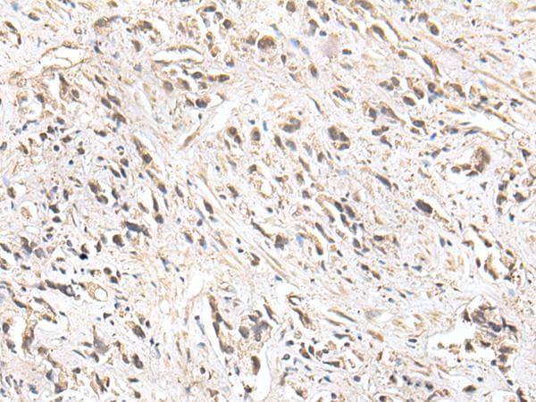 Polyclonal Rabbit anti-Human ZNF281 / Zfp281 Antibody (IHC, WB)