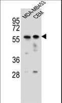 Polyclonal Rabbit anti-Human FOXD4 Antibody (aa182-210, WB)