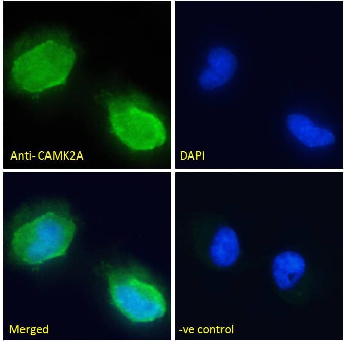 PathPlus™ CAMK2A / CaMKII Alpha Antibody (aa455-468)