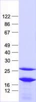Human EIF1AX Protein (Recombinant His, N-Terminal)