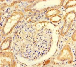 Polyclonal Rabbit anti-Human ARHGAP19 Antibody (WB)