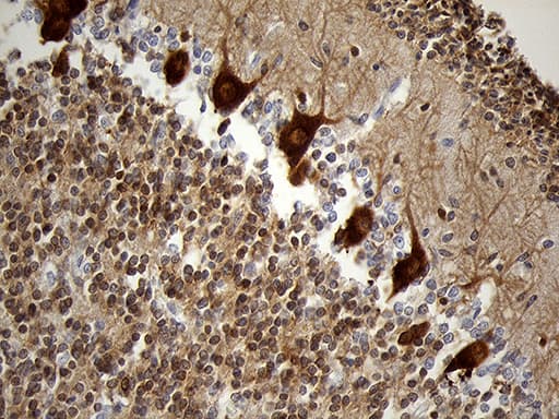 EEF1D Antibody (clone OTI6B3)