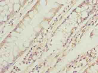 TMEM71 Antibody