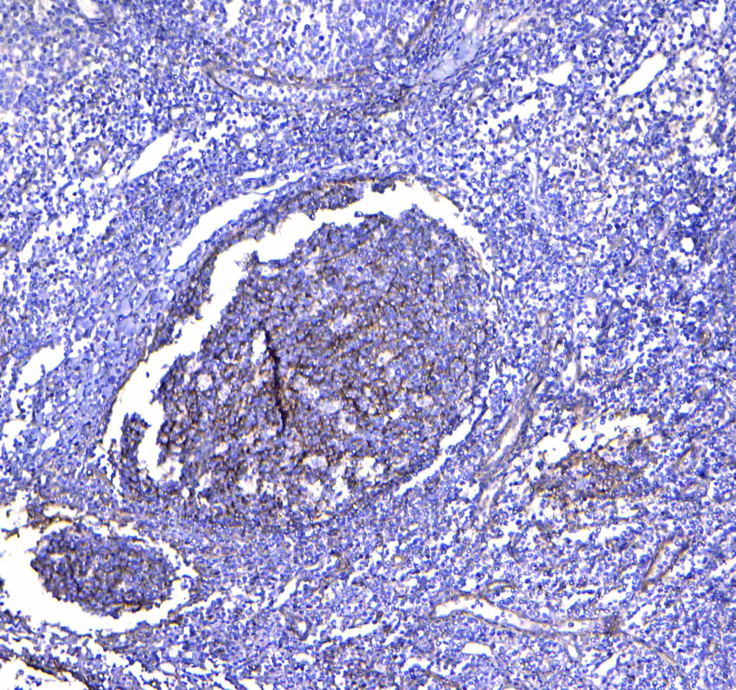 CD81 Antibody