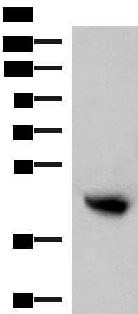 Polyclonal Rabbit anti-Human KIR2DL5A / KIR2DL5 Antibody (IHC, WB)