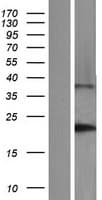 DNAL1 Protein (Over-Expression Lysate Myc-DDK (Flag))