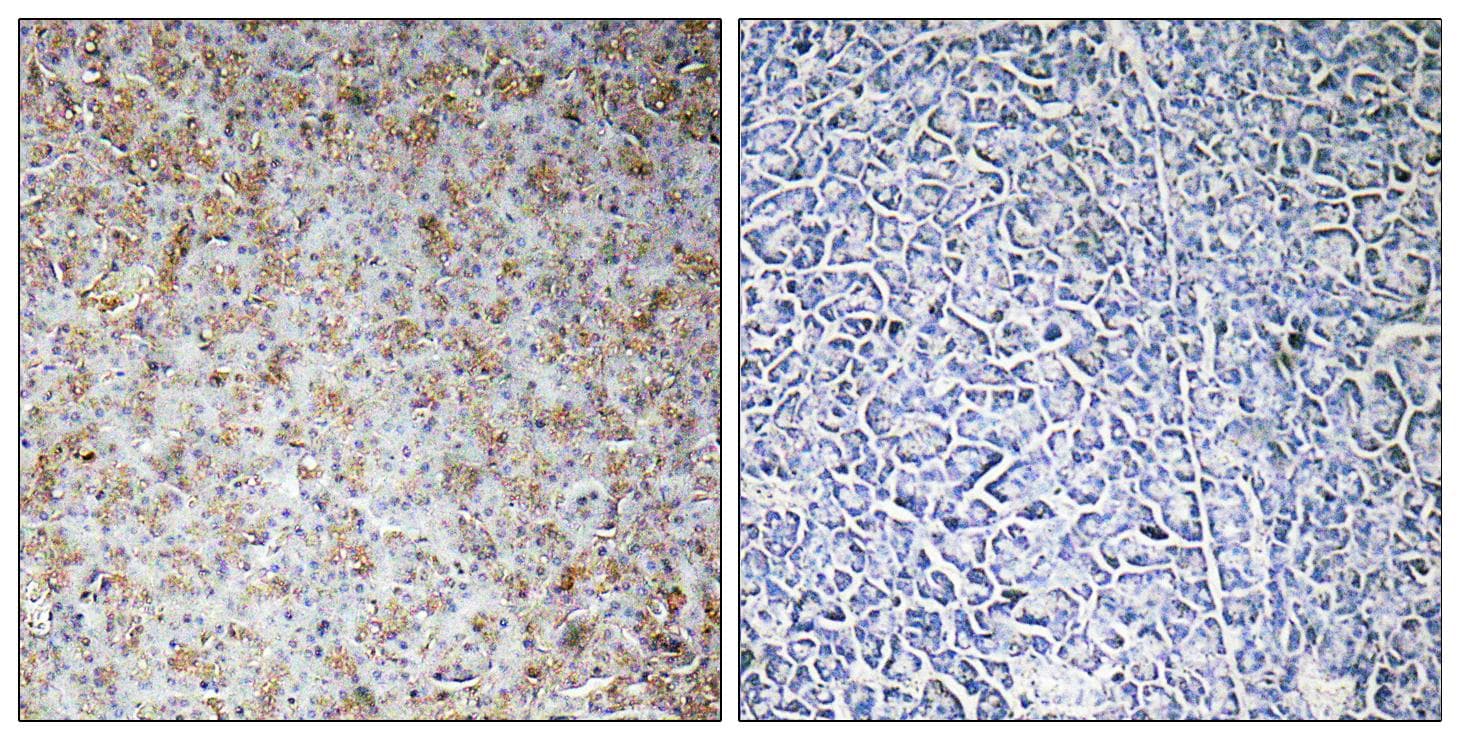 Polyclonal Rabbit anti-Human WASF2 / SCAR2 Antibody (IHC, WB)