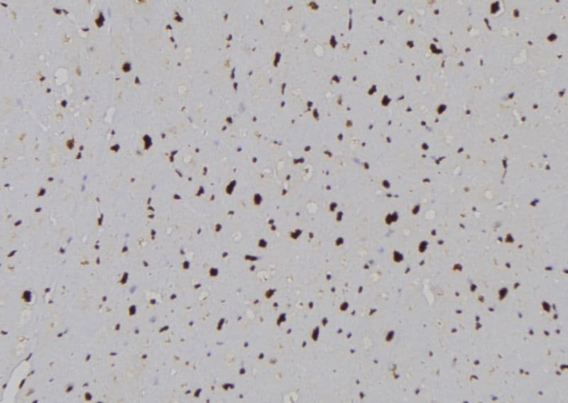 PLCB1 / Phospholipase C Beta 1 Antibody