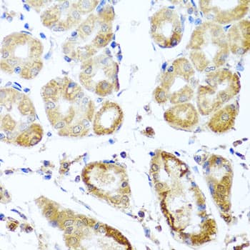 Polyclonal Rabbit anti-Human PER1 Antibody (IHC, WB)