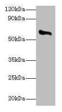 IHC-plus™ Polyclonal Rabbit anti-Human P450SCC / CYP11A1 Antibody (aa40-521, IHC, WB)