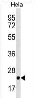 RPL10 / Ribosomal Protein L10 Antibody (aa17-45)