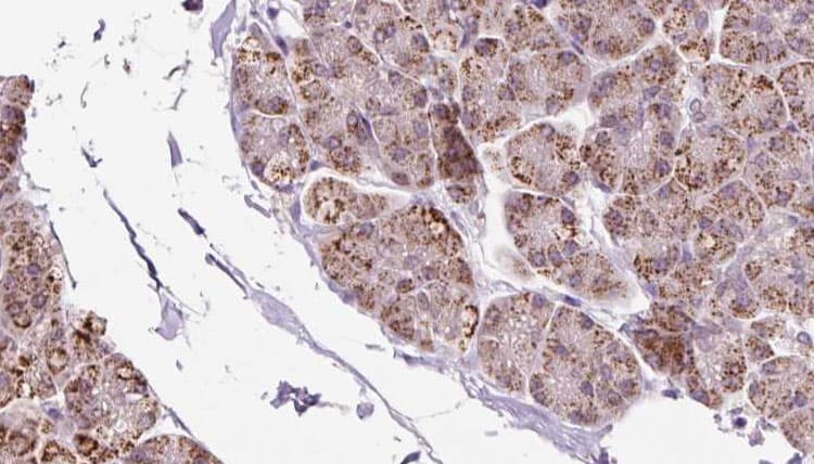 EIF2B1 Antibody