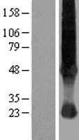 SLC37A4 / G6PT Protein (Over-Expression Lysate Myc-DDK (Flag))