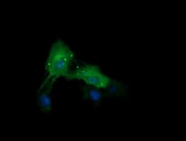 CTAG1B / NY-ESO-1 Antibody (clone OTI1C4, Carrier-free)