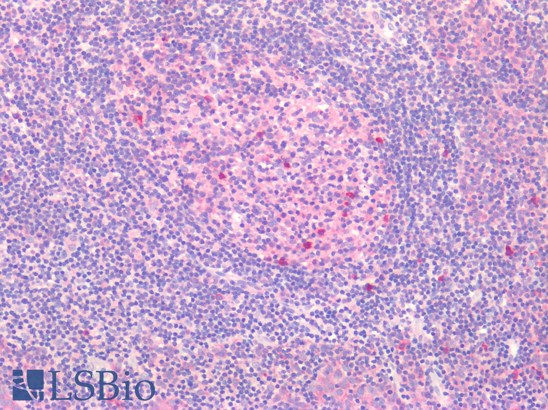 PathPlus™ CD71 / Transferrin Receptor Antibody (clone 1E6)