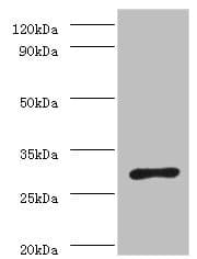 Polyclonal Rabbit anti-H. pylori ureA / Urease Alpha Antibody (WB)