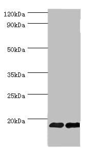 FGF1 / Acidic FGF Antibody (aa16-155)