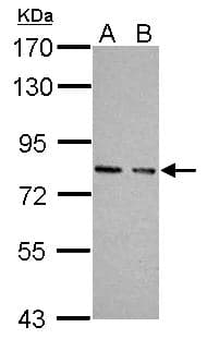 PKG / PRKG1 Antibody (aa1-300)