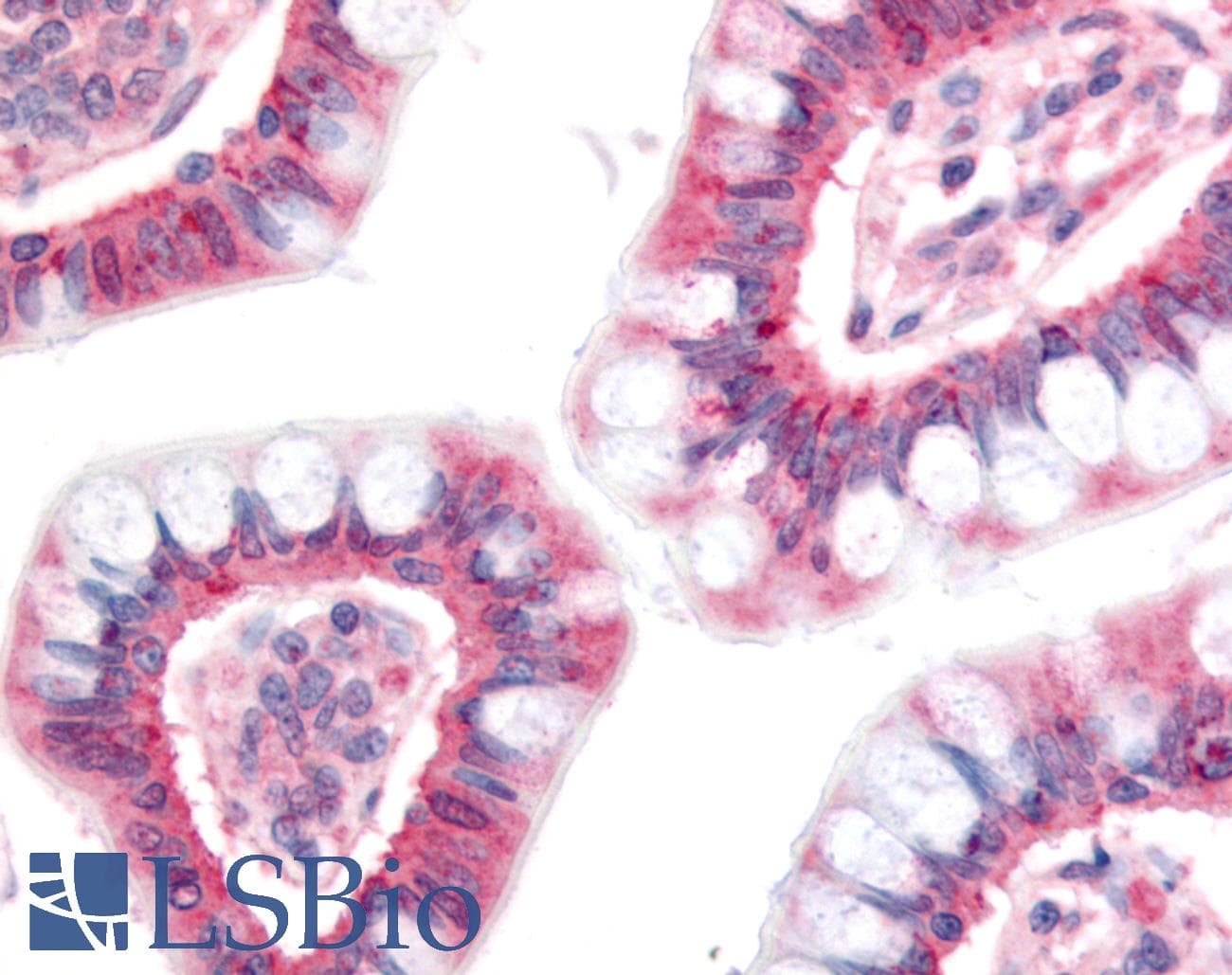 IHC-plus™ NPC1L1 Antibody (aa500-600)