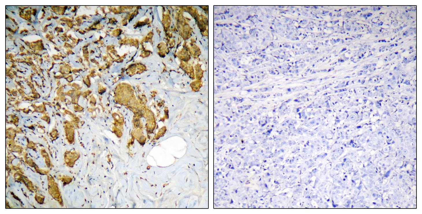 Polyclonal Rabbit anti-Human PDHA1 / PDH E1 Alpha Antibody (IHC, WB)
