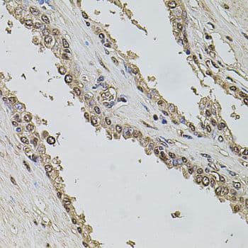 SET / TAF-I Antibody