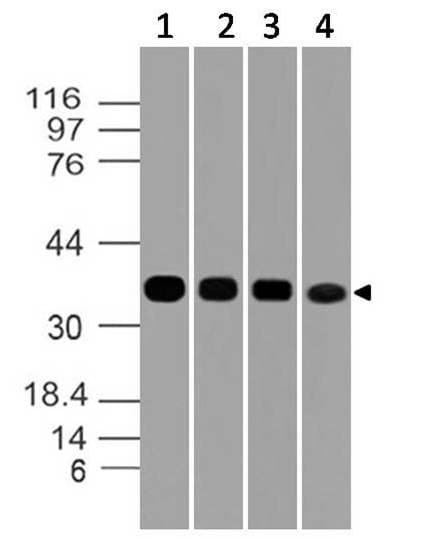 IHC-plus™ Monoclonal Mouse anti-Human GAPDH Antibody (clone ABM22C5, aa120-320, IHC, WB)