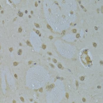 Polyclonal Rabbit anti-Human HNRNPK / hnRNP K Antibody (IHC, IF, WB)