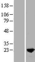MLC2 / MYL9 Protein (Over-Expression Lysate Myc-DDK (Flag))