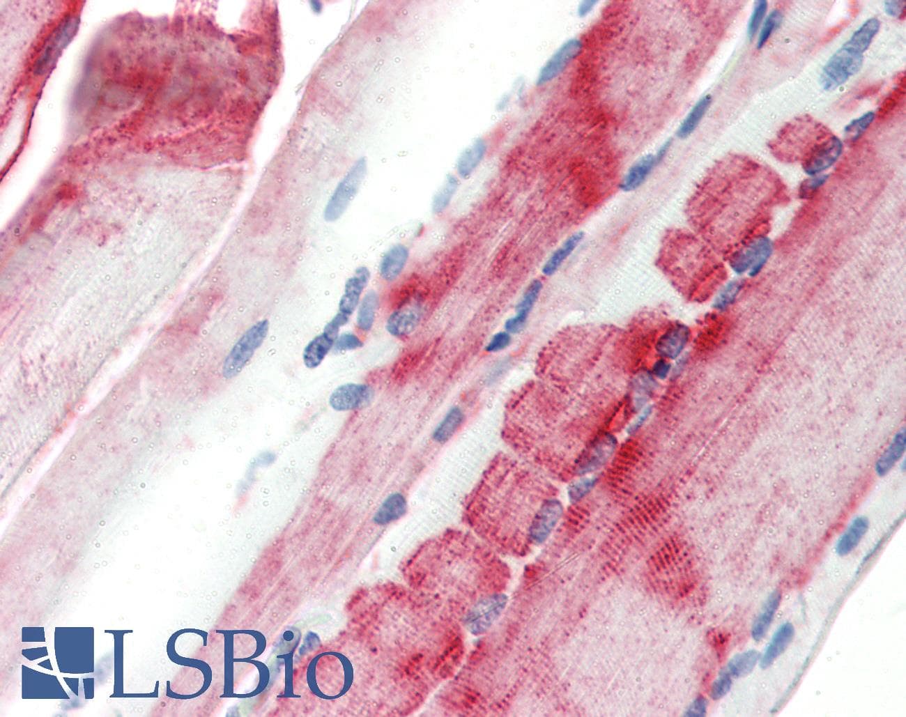 IHC-plus™ CRYAB / Alpha B Crystallin Antibody (clone 1B6.1-3G4)