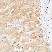 F2 / Prothrombin / Thrombin Antibody