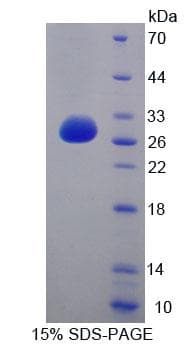 Human CDC27 Protein (Recombinant His-T7, N-terminus)
