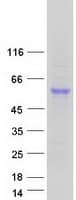 Human CPVL Protein (Recombinant Myc-DDK (Flag))