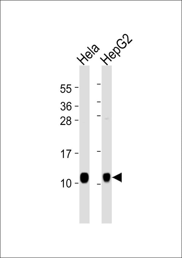 Polyclonal Rabbit anti-Human NDUFA4 Antibody (WB)
