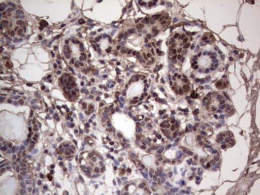 Monoclonal Mouse anti-Human SAE1 Antibody (clone OTI6B11, Carrier-free, IHC, WB)