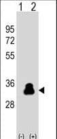 Polyclonal Rabbit anti-Human KLK4 / Kallikrein 4 Antibody (aa85-115, WB)